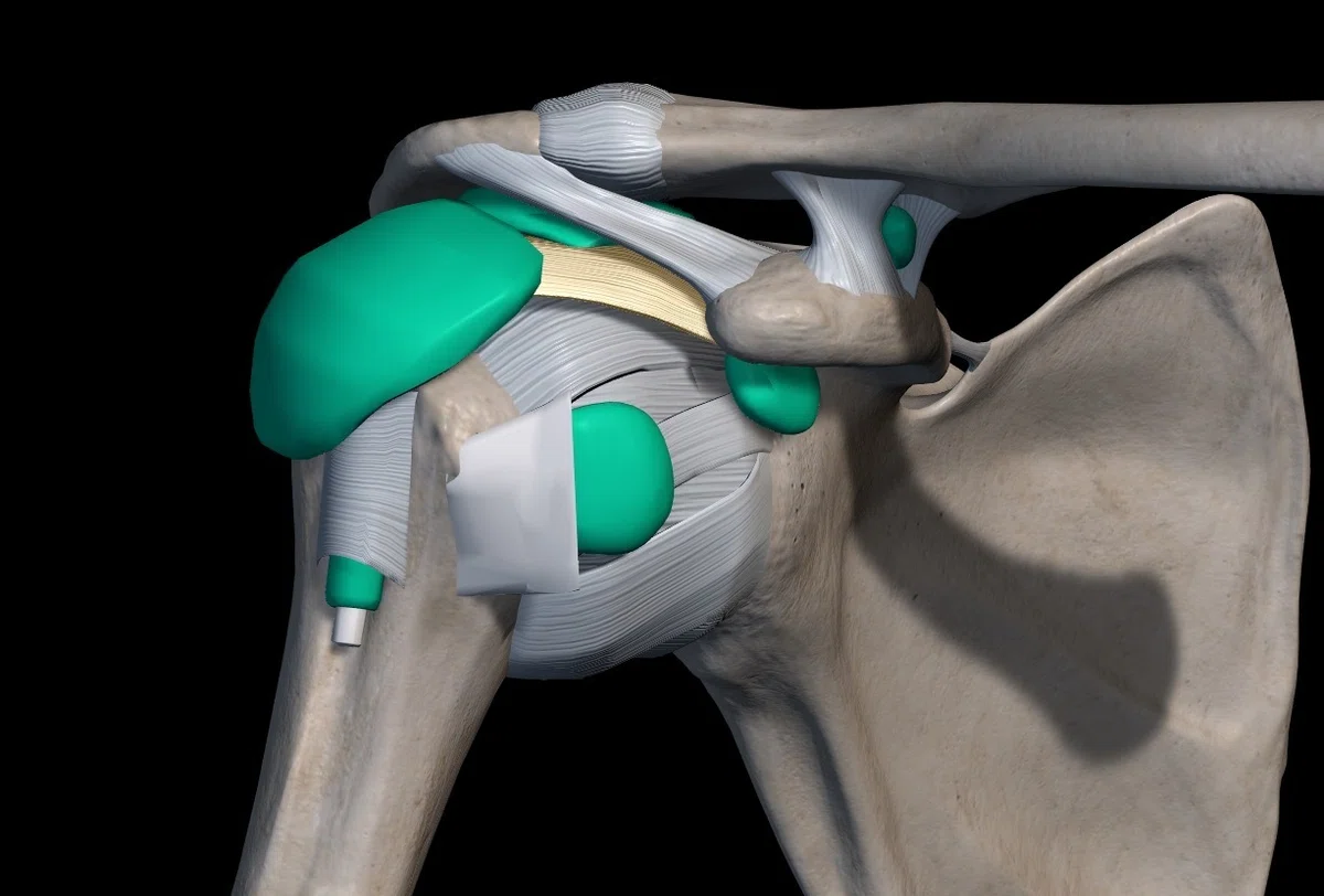 [Shoulder Joint] What are the causes of stiff internal and external ...