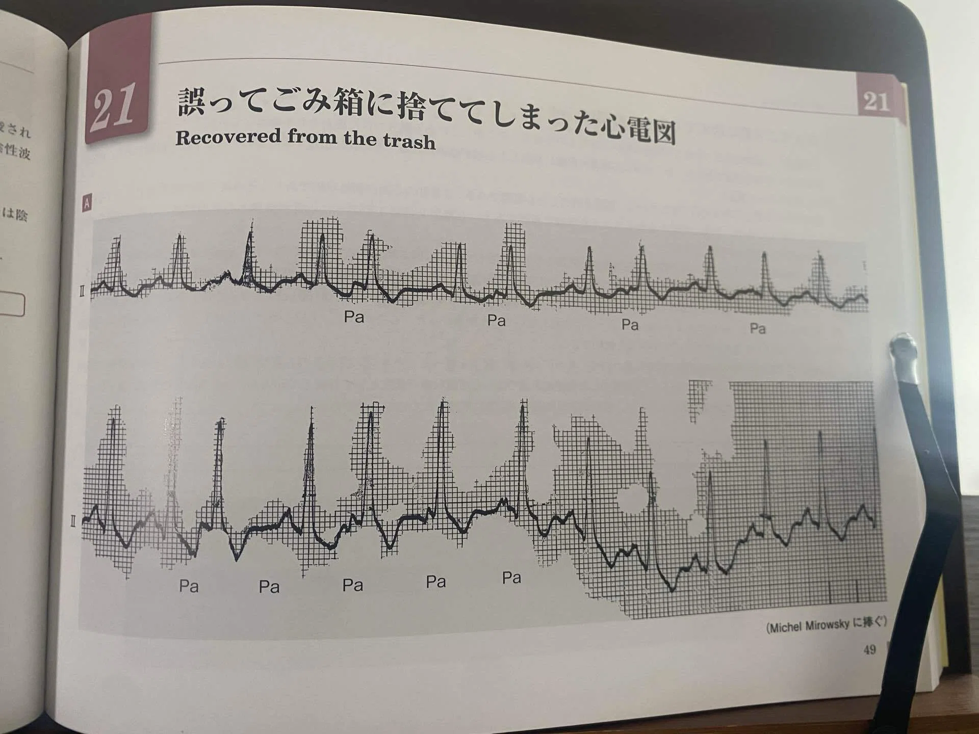ブルガダ三兄弟の心電図リーディング・メソッド82を読んでみました｜CE