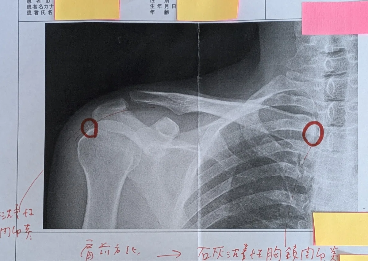 画像