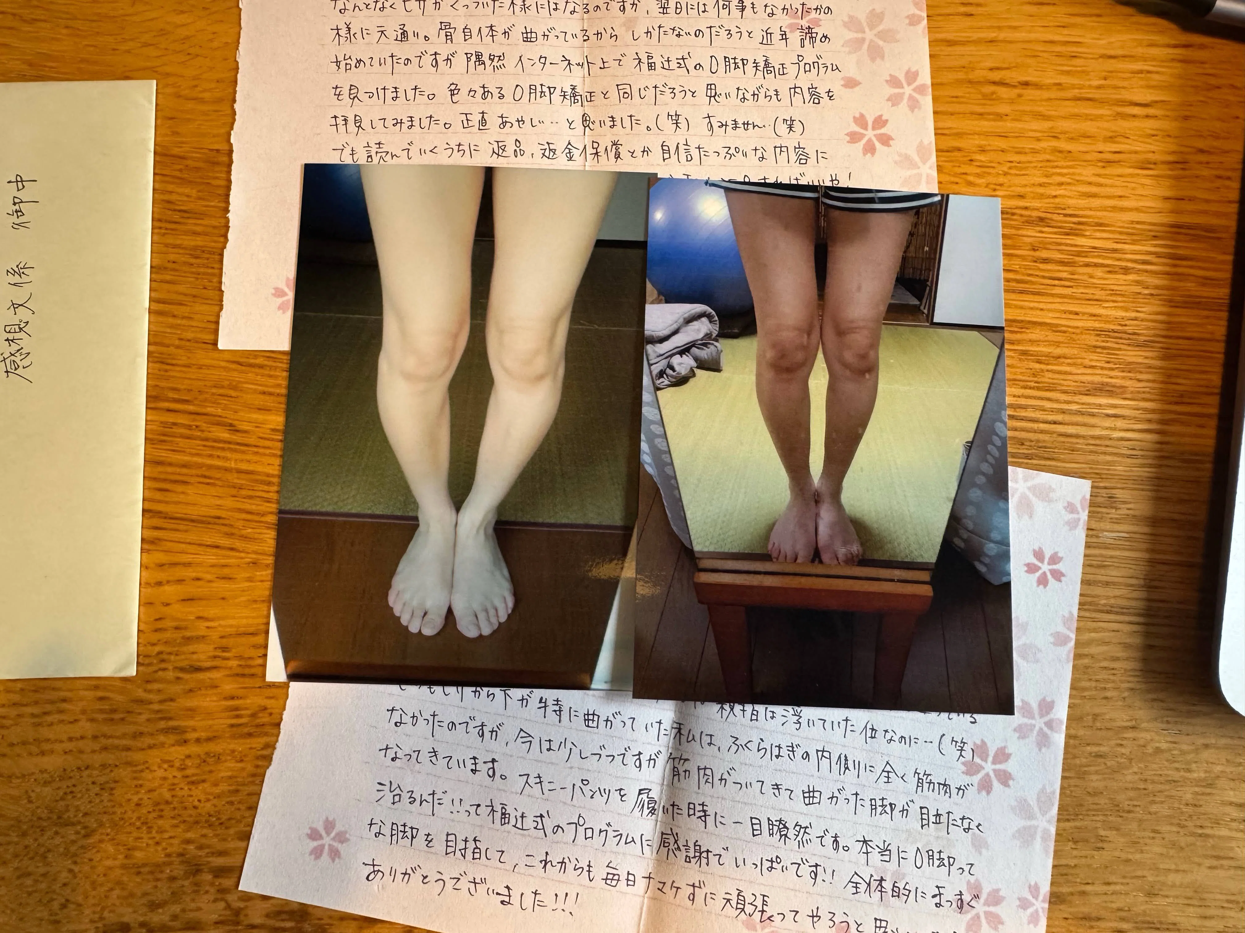 膝下O脚「ありとあらゆるO脚グッズを試し、O脚矯正のエステや整体にも