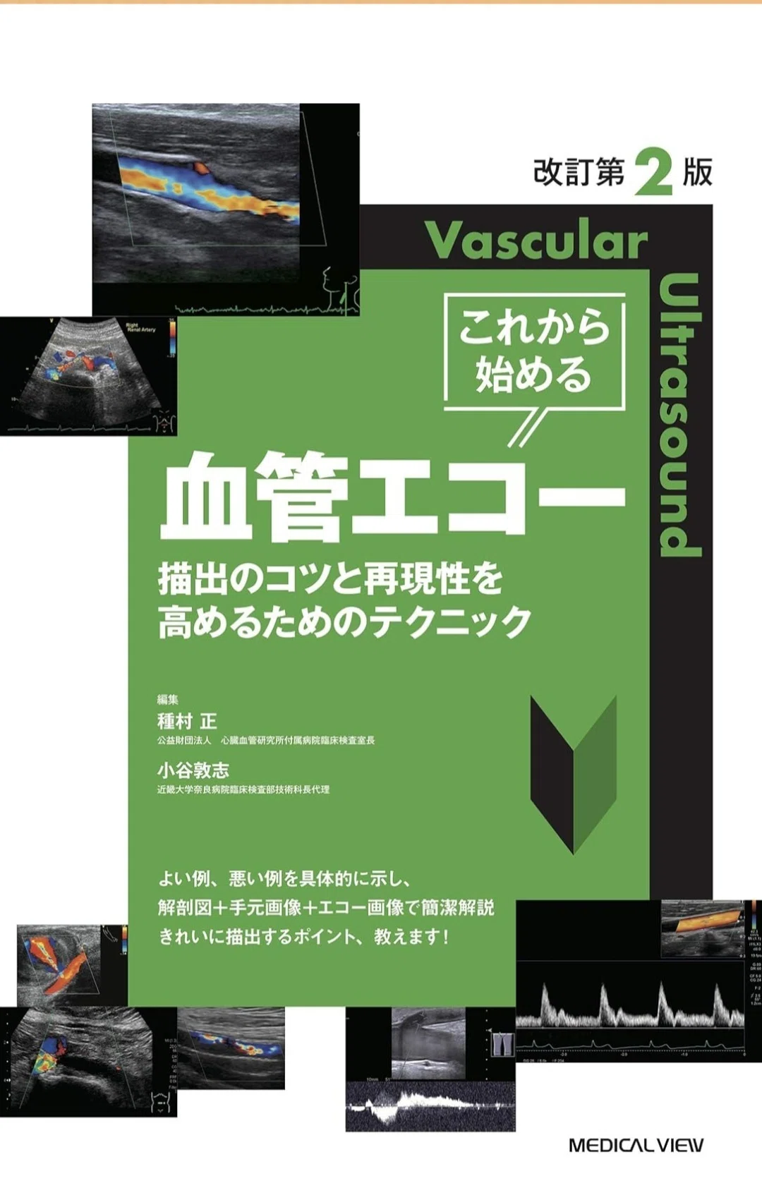 超音波検査おすすめ参考書まとめ｜頸動脈エコー編｜もんた｜フリー
