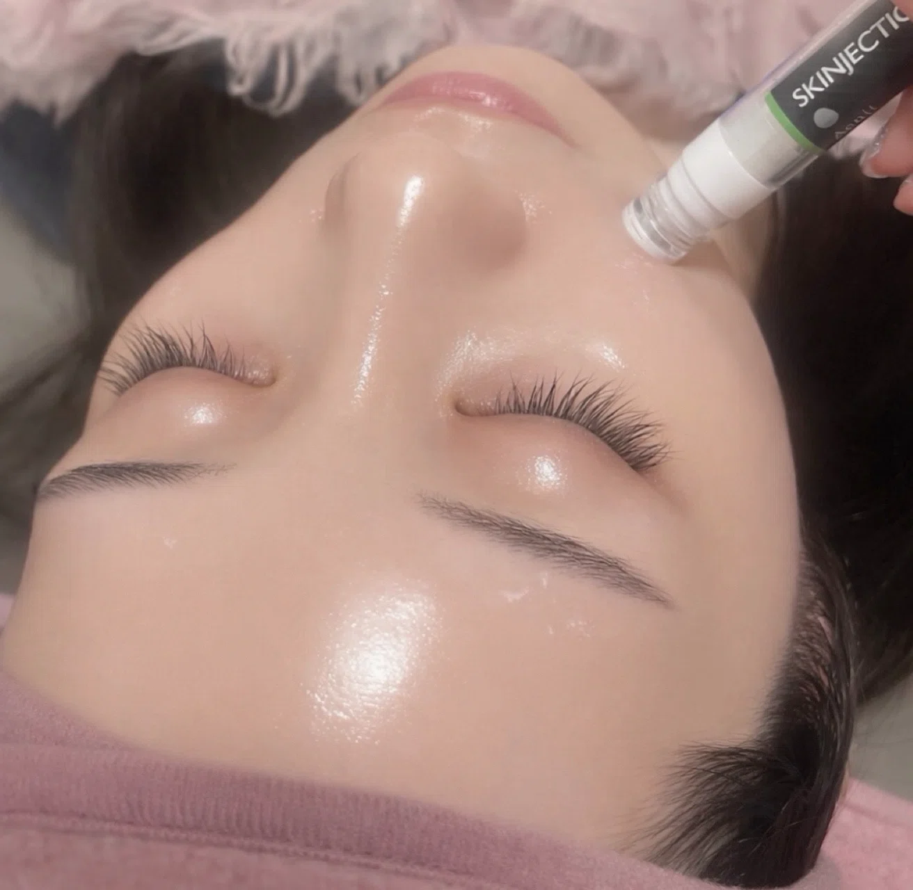 マイクロニードルで水光肌♪韓国エステ版ポテンツァ｜Yuence Beaute