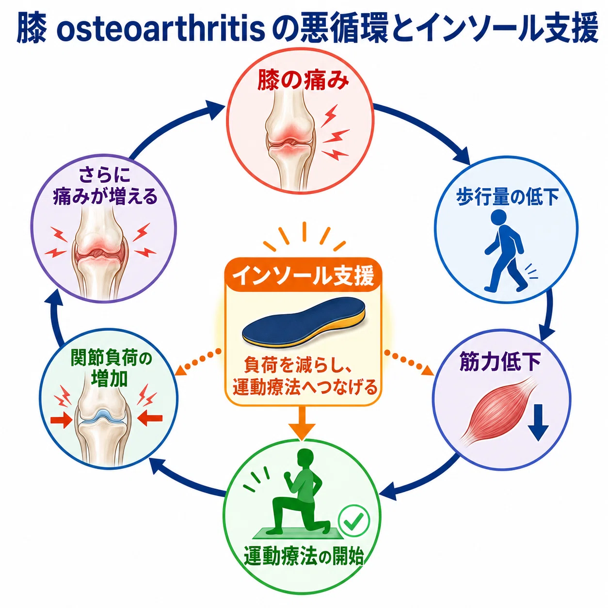 変形性膝関節症にインソールは効くのか？運動療法と組み合わせる現場の