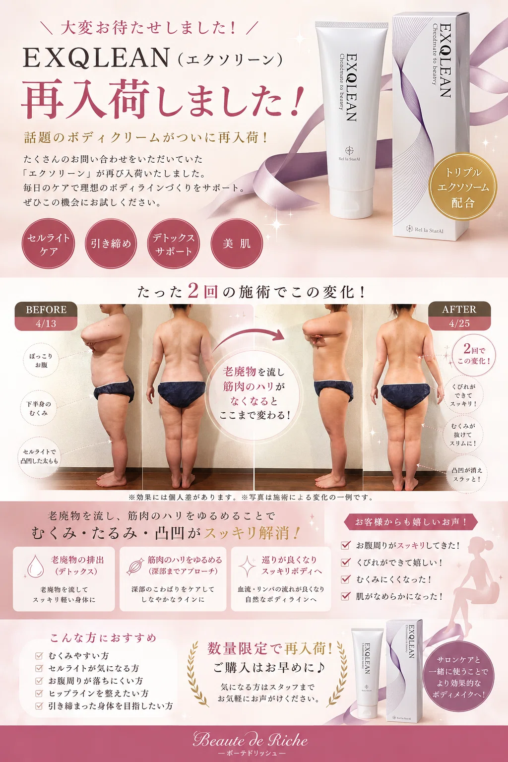 売れ筋！塗るだけで、痩せやすい身体づくりができる痩身ジェルクリーム