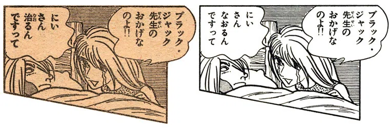 単行本解説⑪】少年チャンピオンコミックス『ブラック・ジャック』11巻
