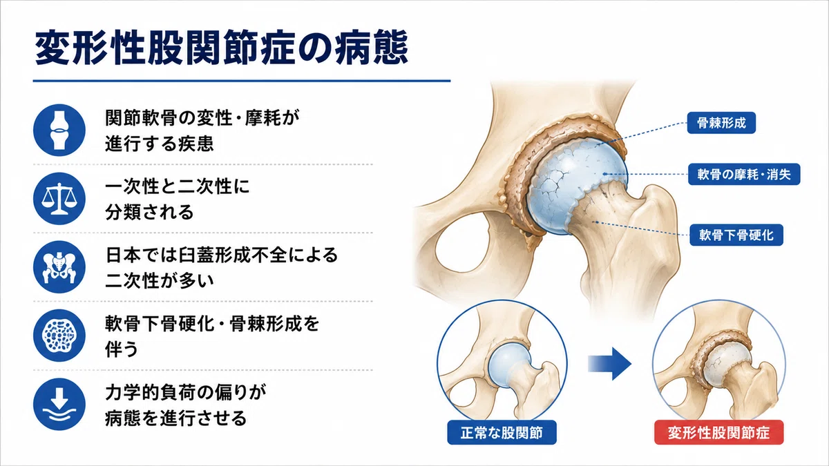 変形性股関節症の評価・理学療法・手術療法完全ガイド― 病態理解から