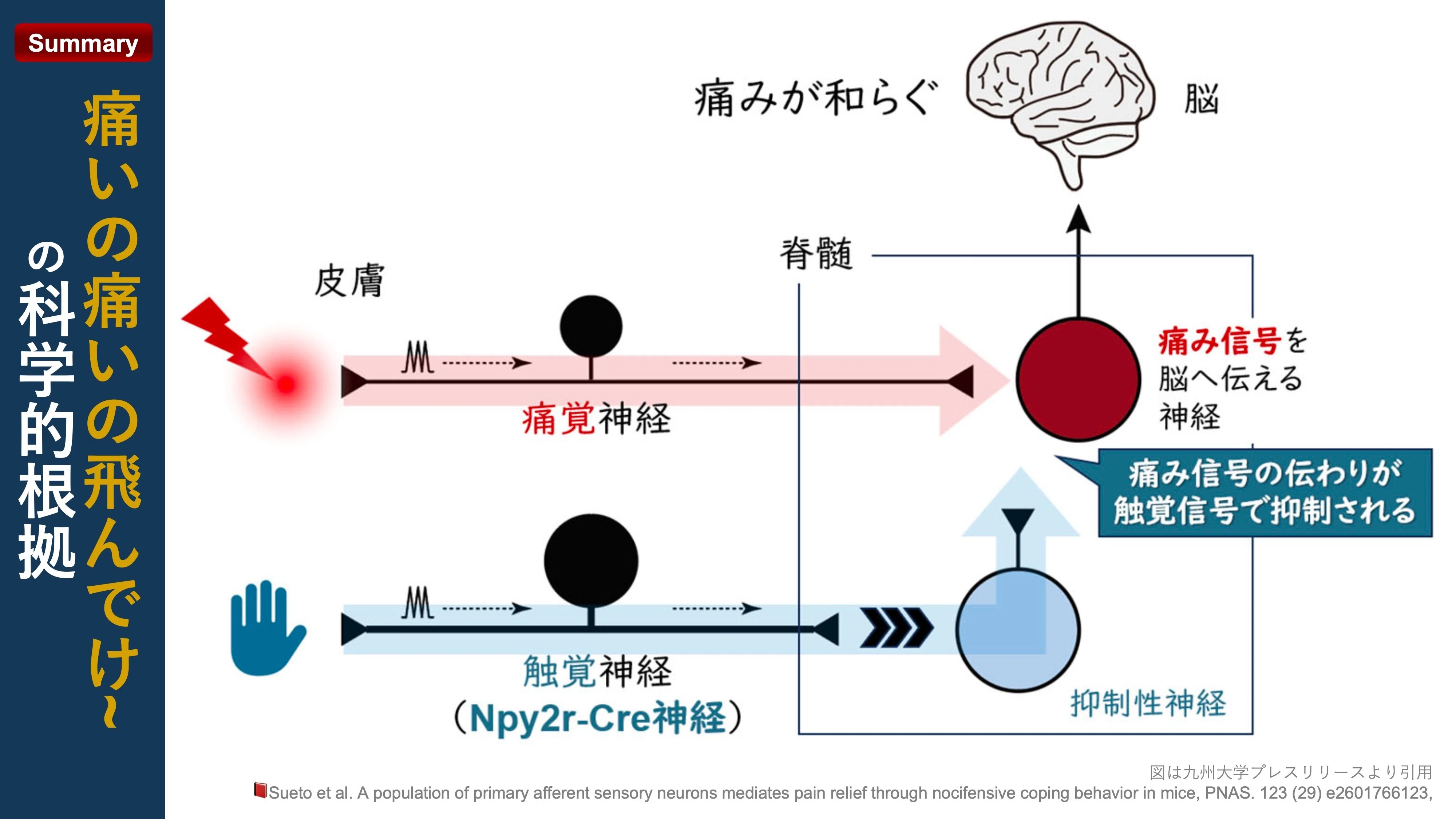 痛いの痛いの飛んでけ〜” の科学的根拠｜Super Human | 理学療法士