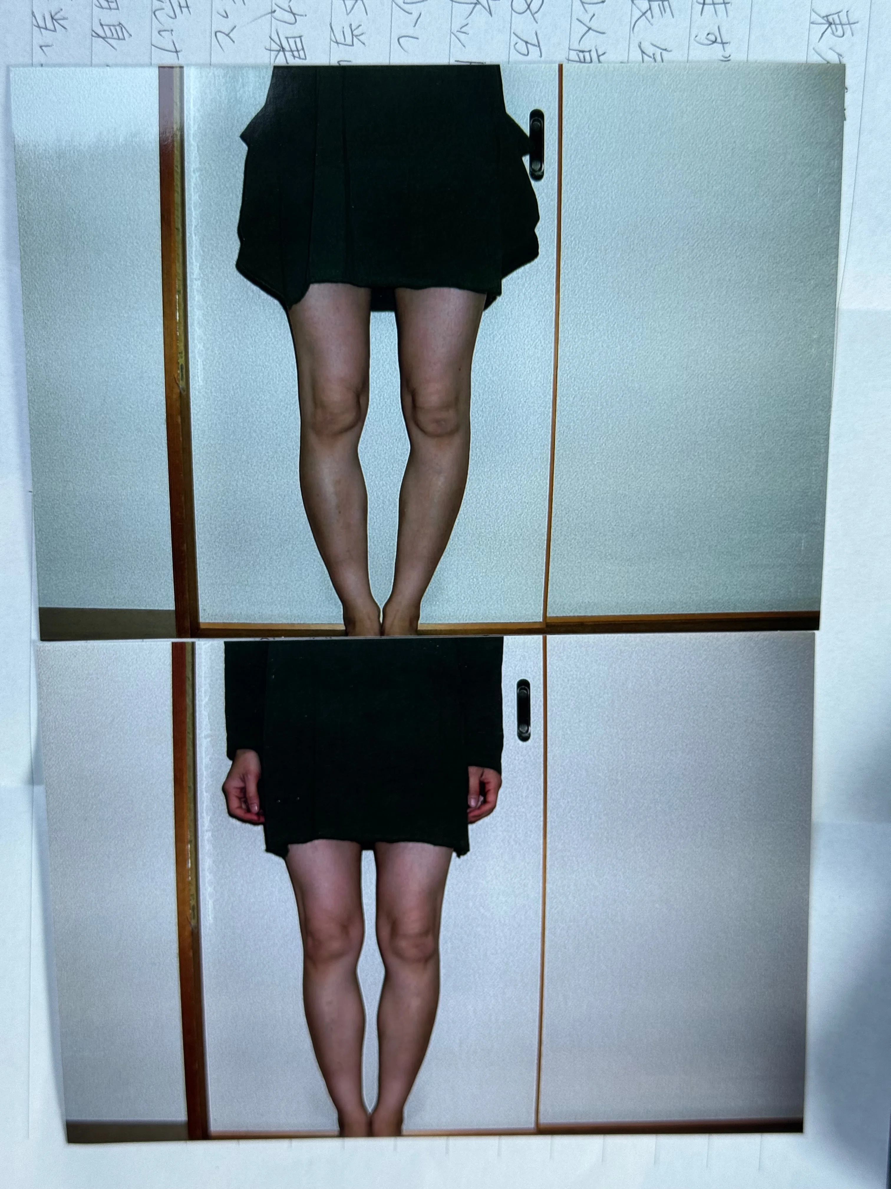 O脚「O脚矯正の整体にも通った時もありました。8万円でした。でも