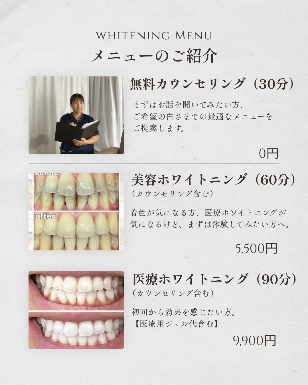 メニューのご紹介🦷✨｜うきは市ホワイトニング専門店