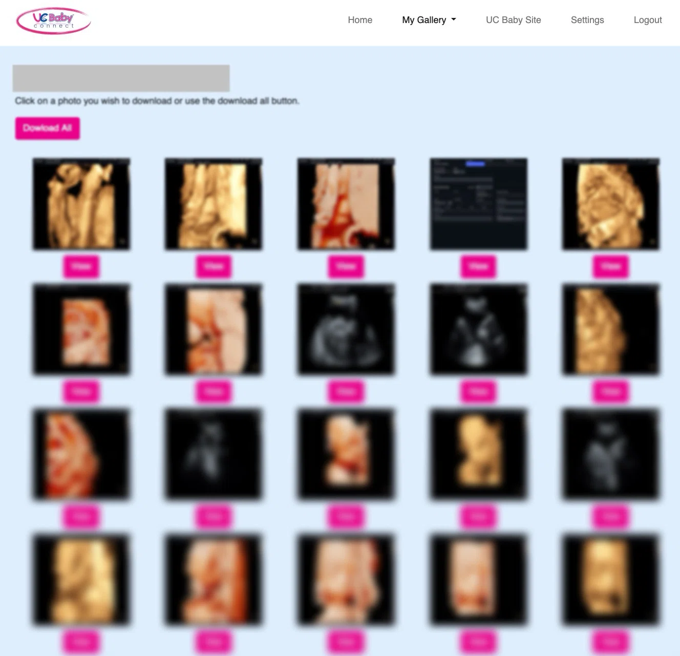 UCbabyのエコー写真
