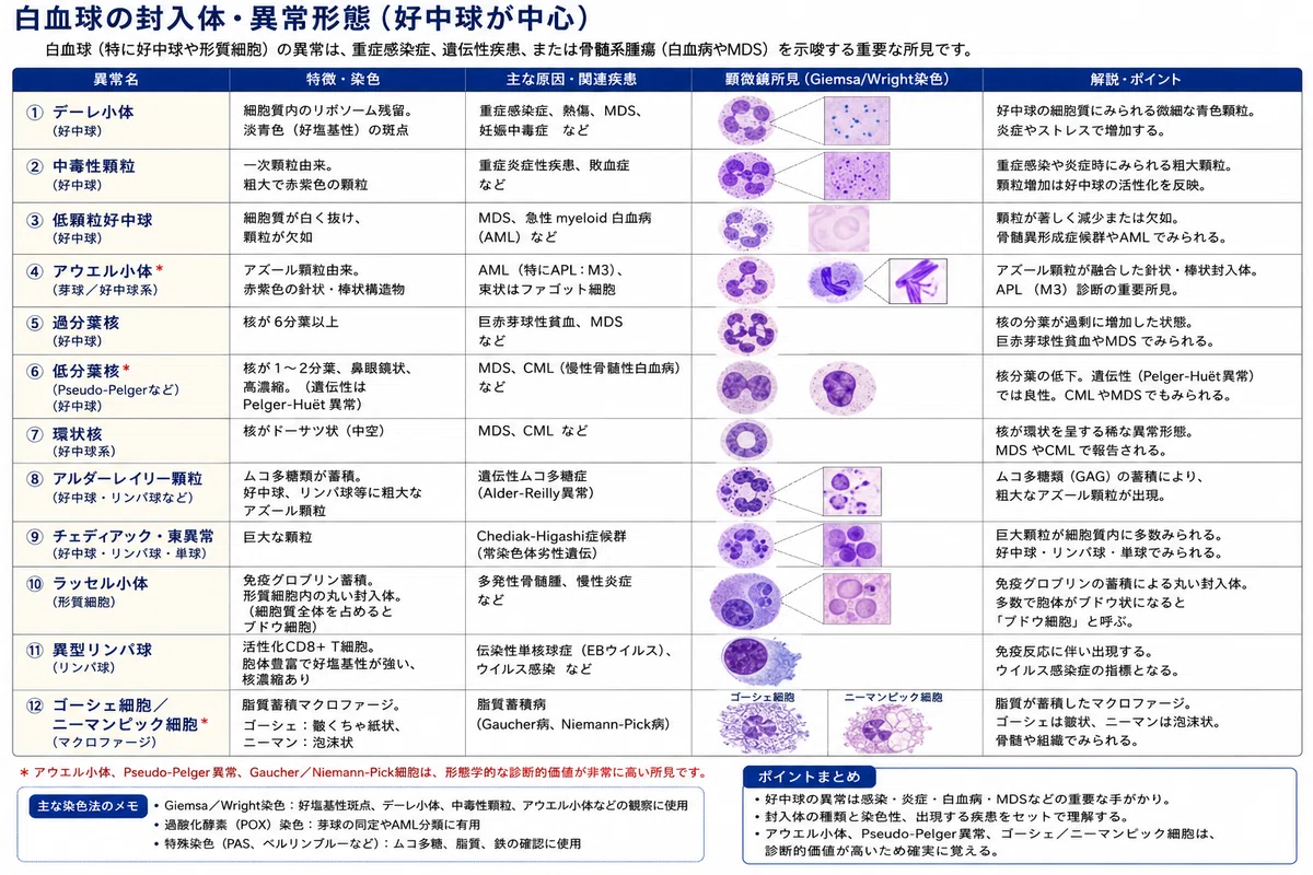 血液検査の「異形リンパ球」とは?白血病との違いや原因・基準値を徹底解説