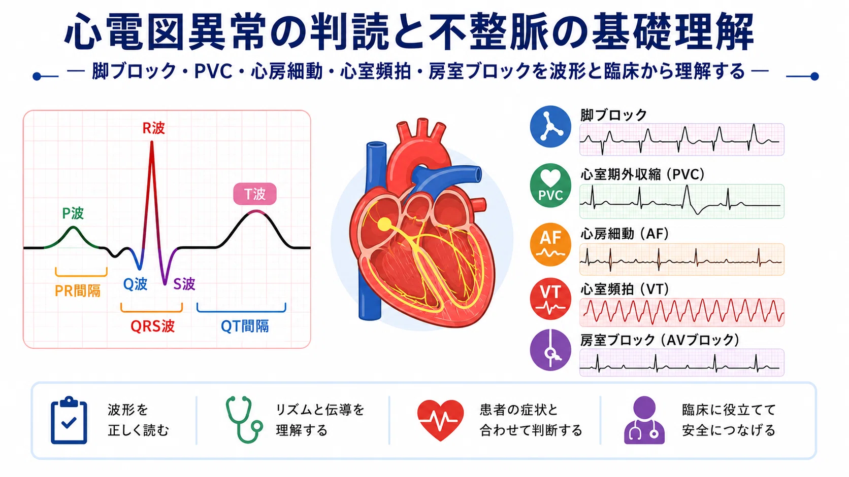 心電図異常を臨床でどう読む？】脚ブロック・PVC・心房細動・心室頻拍