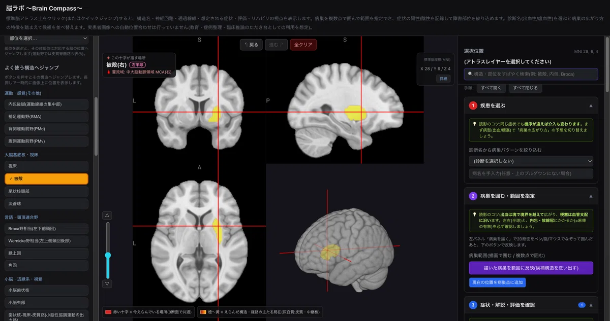 Just tap the cross-section. How to use Brain Compass to instantly check ...