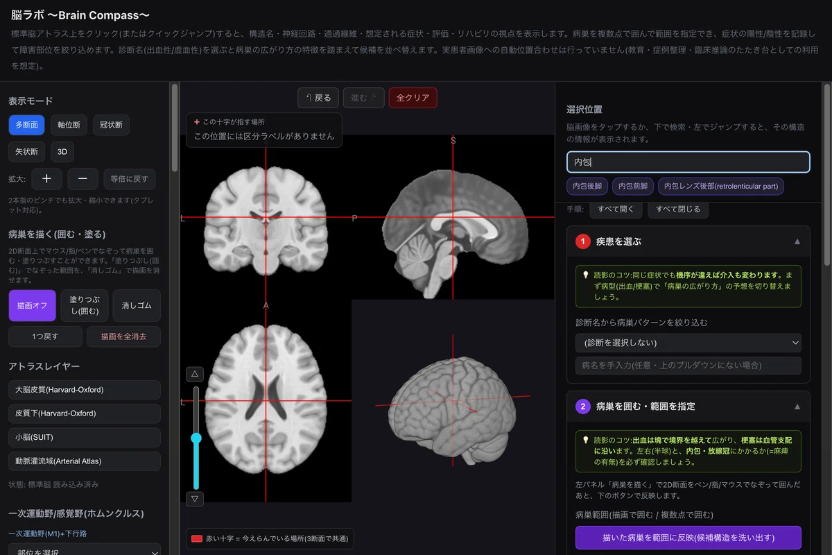 Just tap the cross-section. How to use Brain Compass to instantly check ...