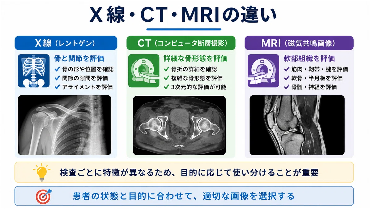 理学療法士のための整形外科画像の読み方｜X線・CT・MRIをリハビリ評価