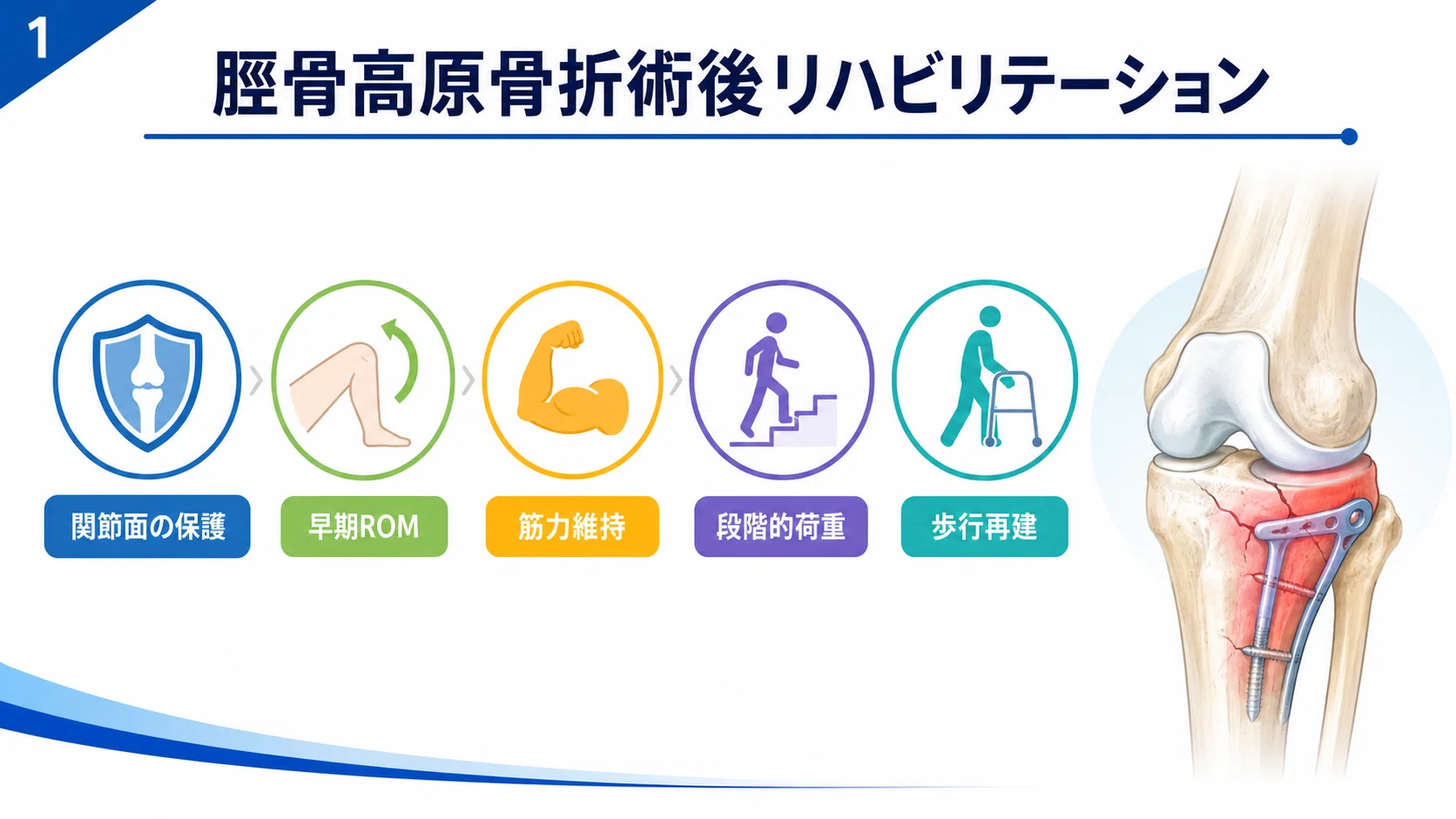 脛骨高原骨折術後リハビリテーション｜術後時期別に学ぶROM・筋力訓練