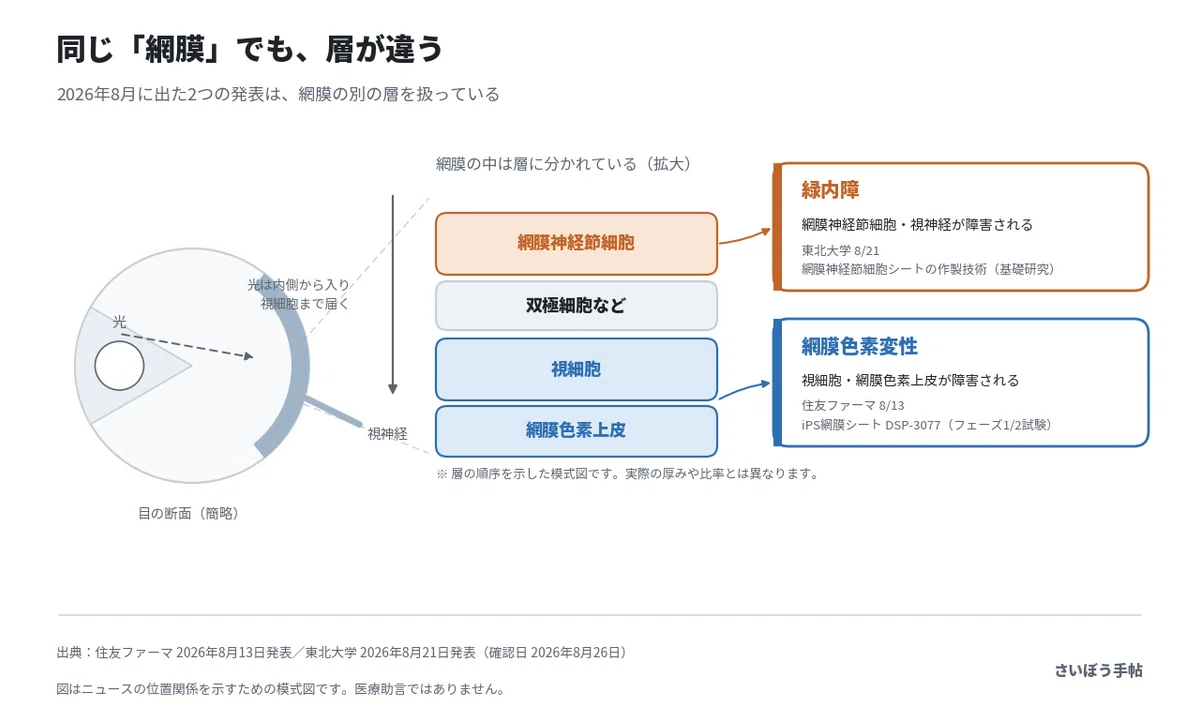 iPS網膜シートと緑内障|「網膜」と一言でいうけれど|くらの/さいぼう手帖