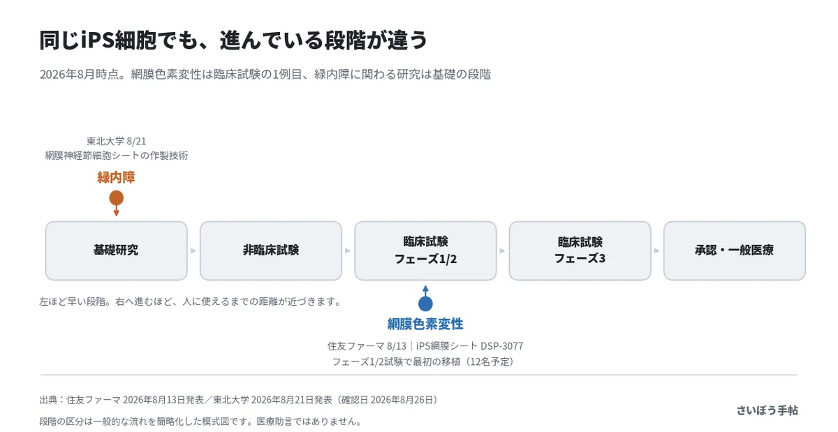 iPS網膜シートと緑内障|「網膜」と一言でいうけれど|くらの/さいぼう手帖