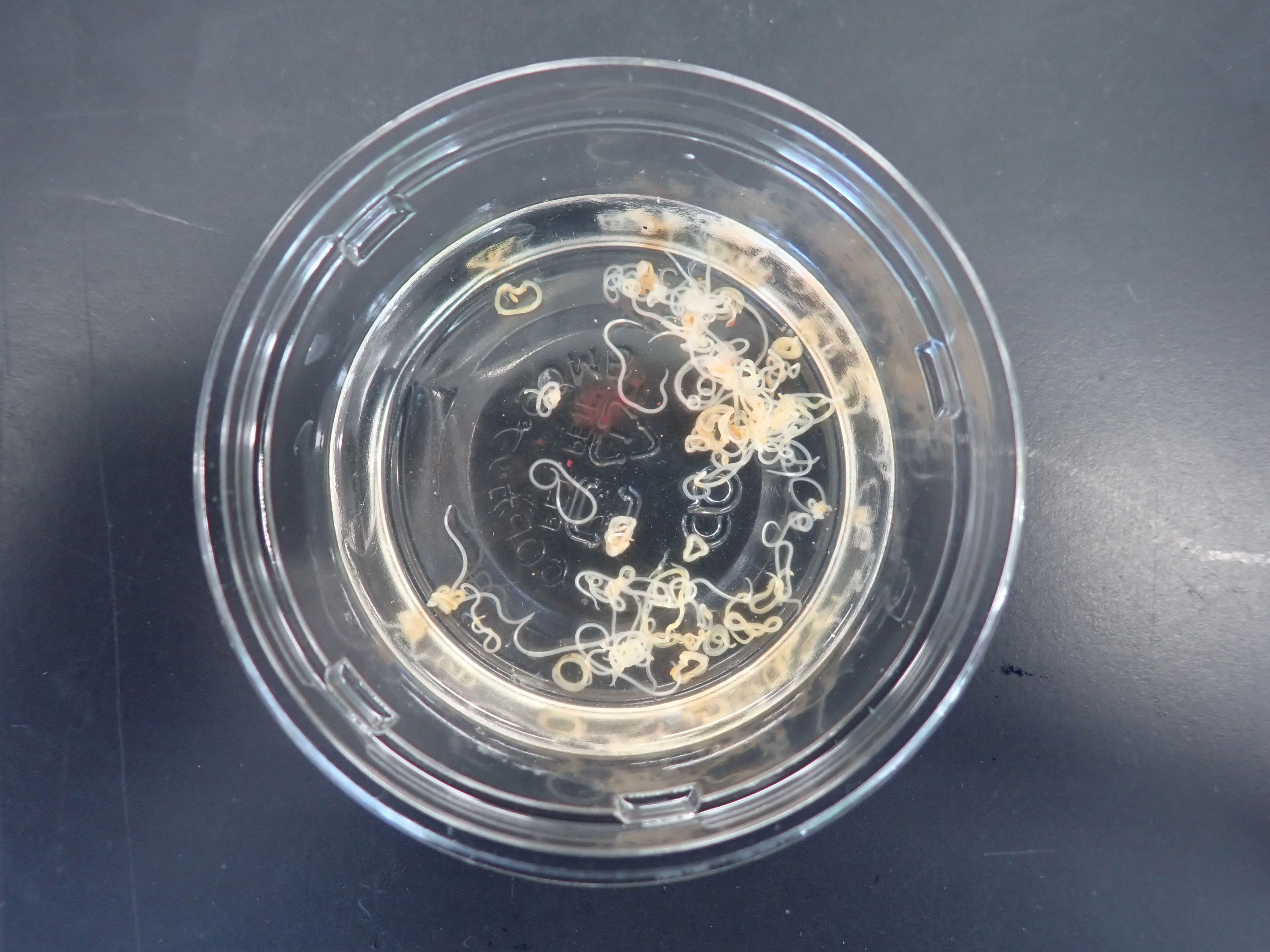 Is that white thread really Anisakis? — Various parasites living inside ...