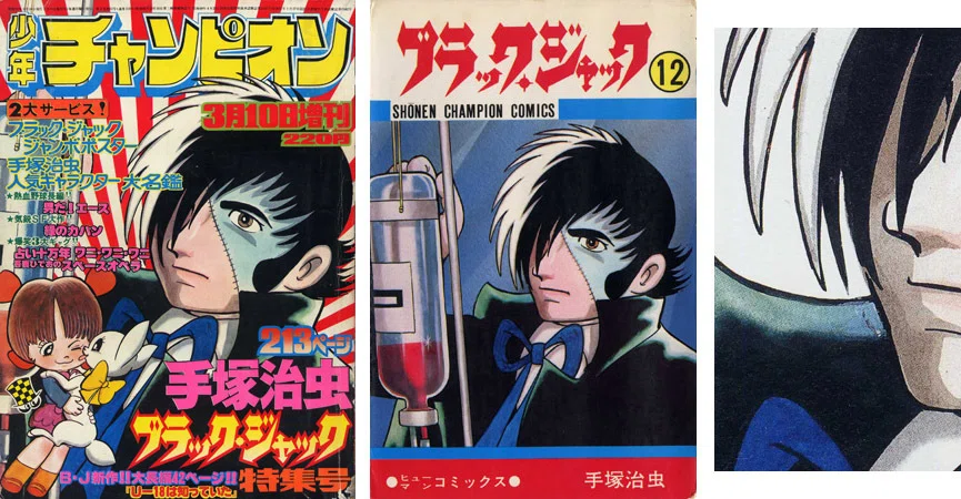 単行本解説⑬】少年チャンピオンコミックス『ブラック・ジャック』12巻