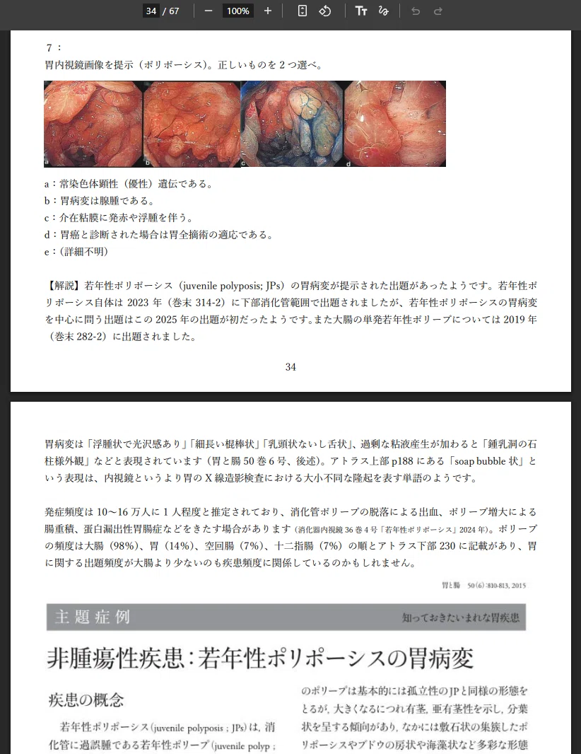 2025年7月①】内視鏡専門医試験 過去問考察ノート（総論＋上部）｜内視