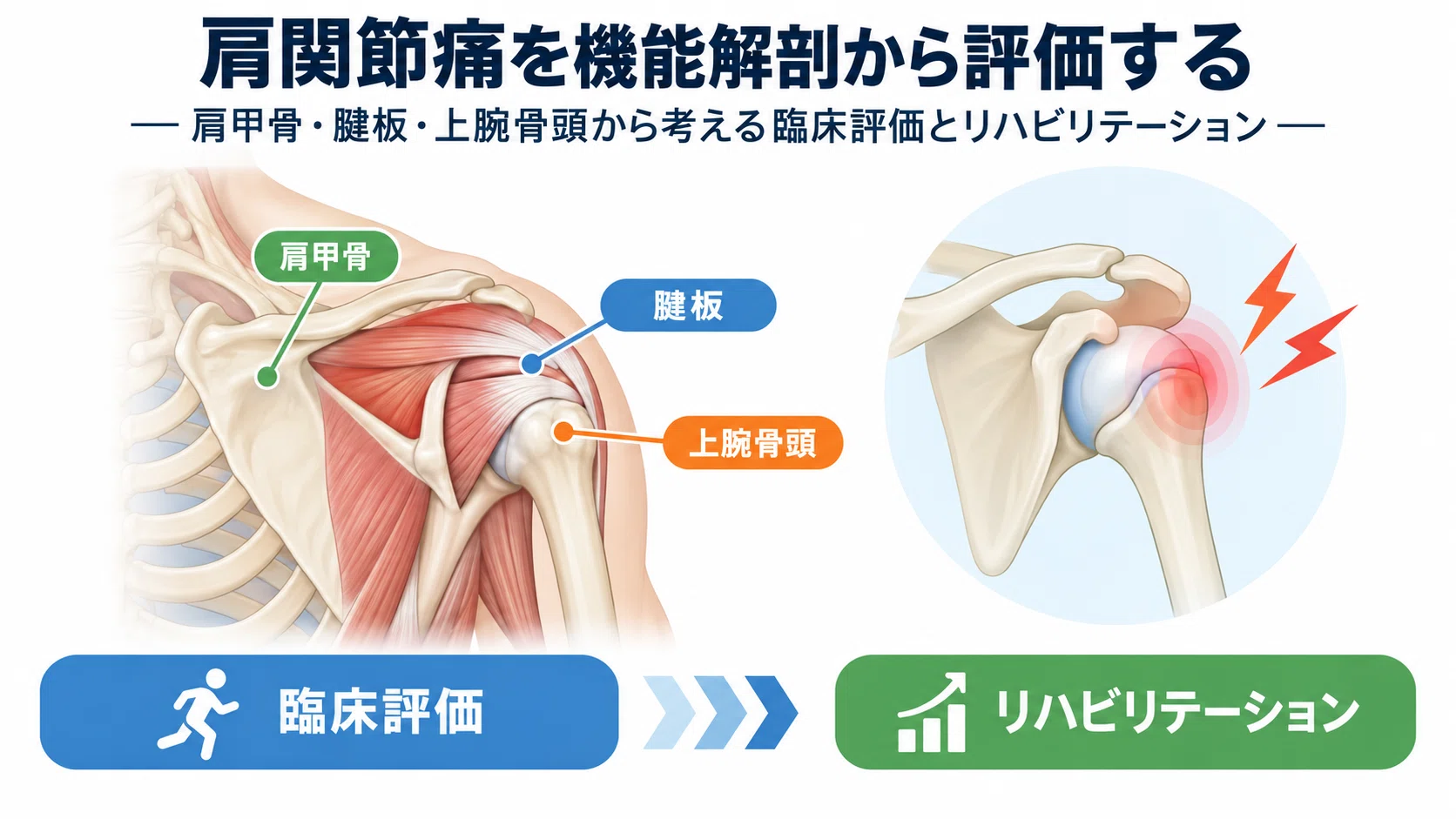 肩関節痛の評価とリハビリテーション｜肩甲骨・腱板・上腕骨頭を機能
