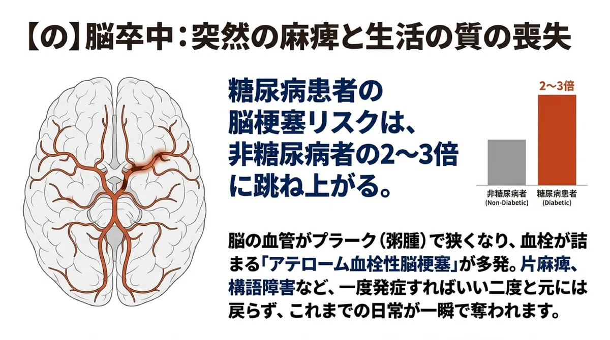 脳梗塞と低血圧の危険な関係とは?血圧下げすぎのリスクと急性期管理の全貌を徹底解説