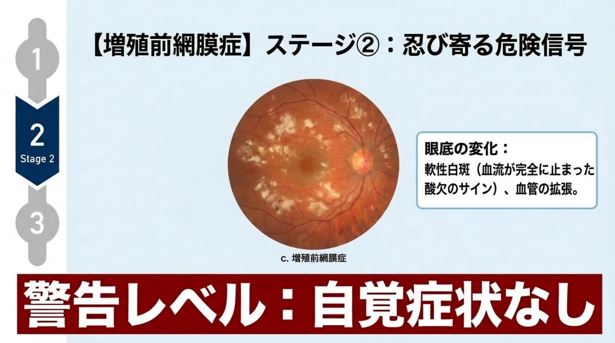 眼科医・内科医が徹底解説】糖尿病網膜症で失明しないための全知識