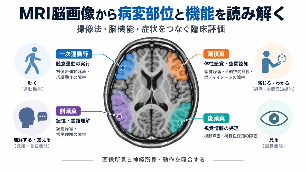 MRI脳画像から病変部位と機能を読み解く―撮像法・脳機能・症状をつなぐ