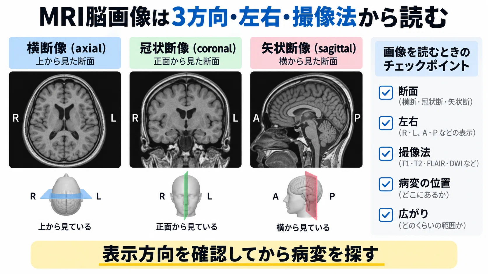 MRI脳画像から病変部位と機能を読み解く―撮像法・脳機能・症状をつなぐ