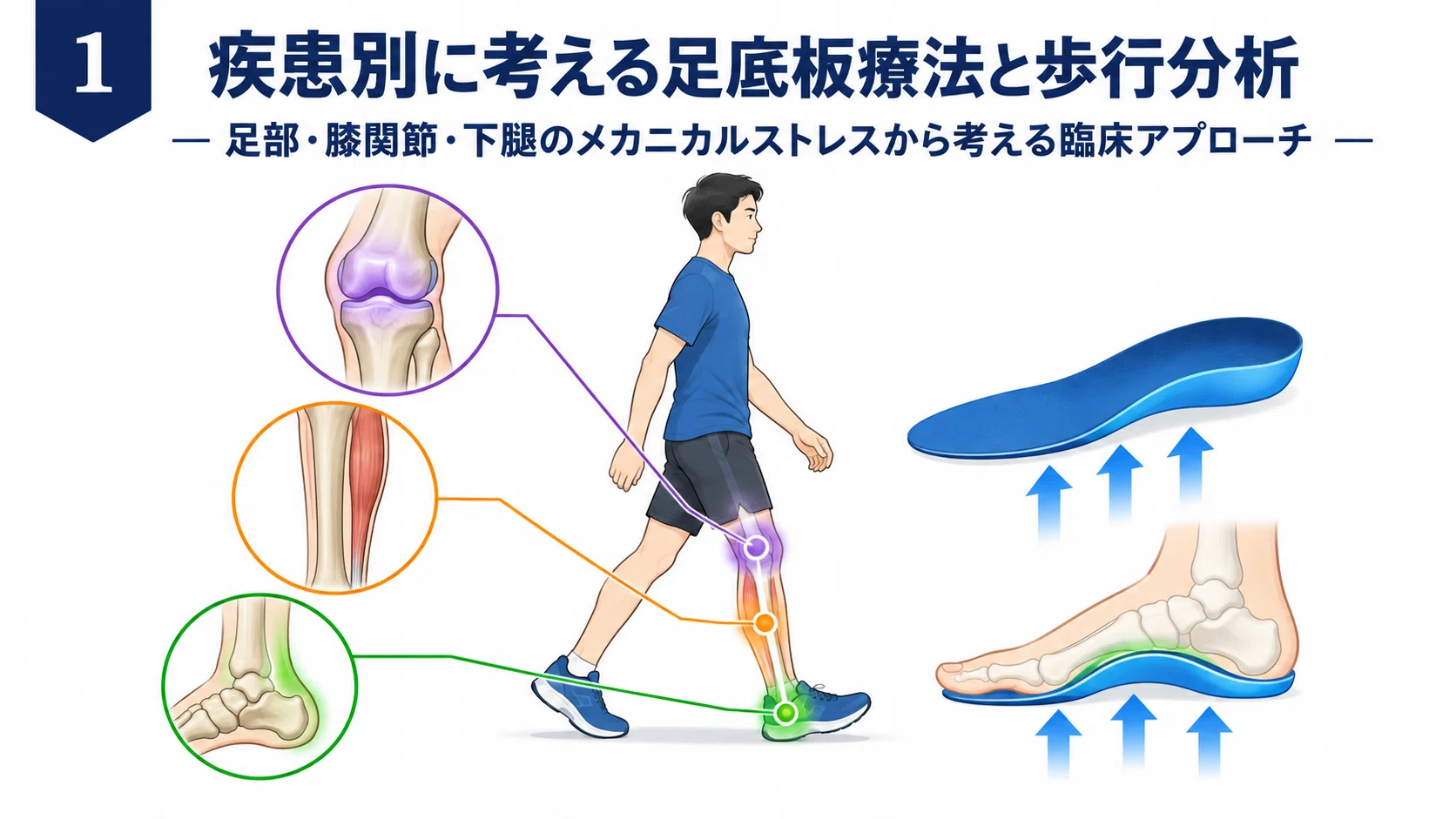 疾患別に学ぶ足底板療法と歩行分析｜足部・膝関節・下腿のメカニカル
