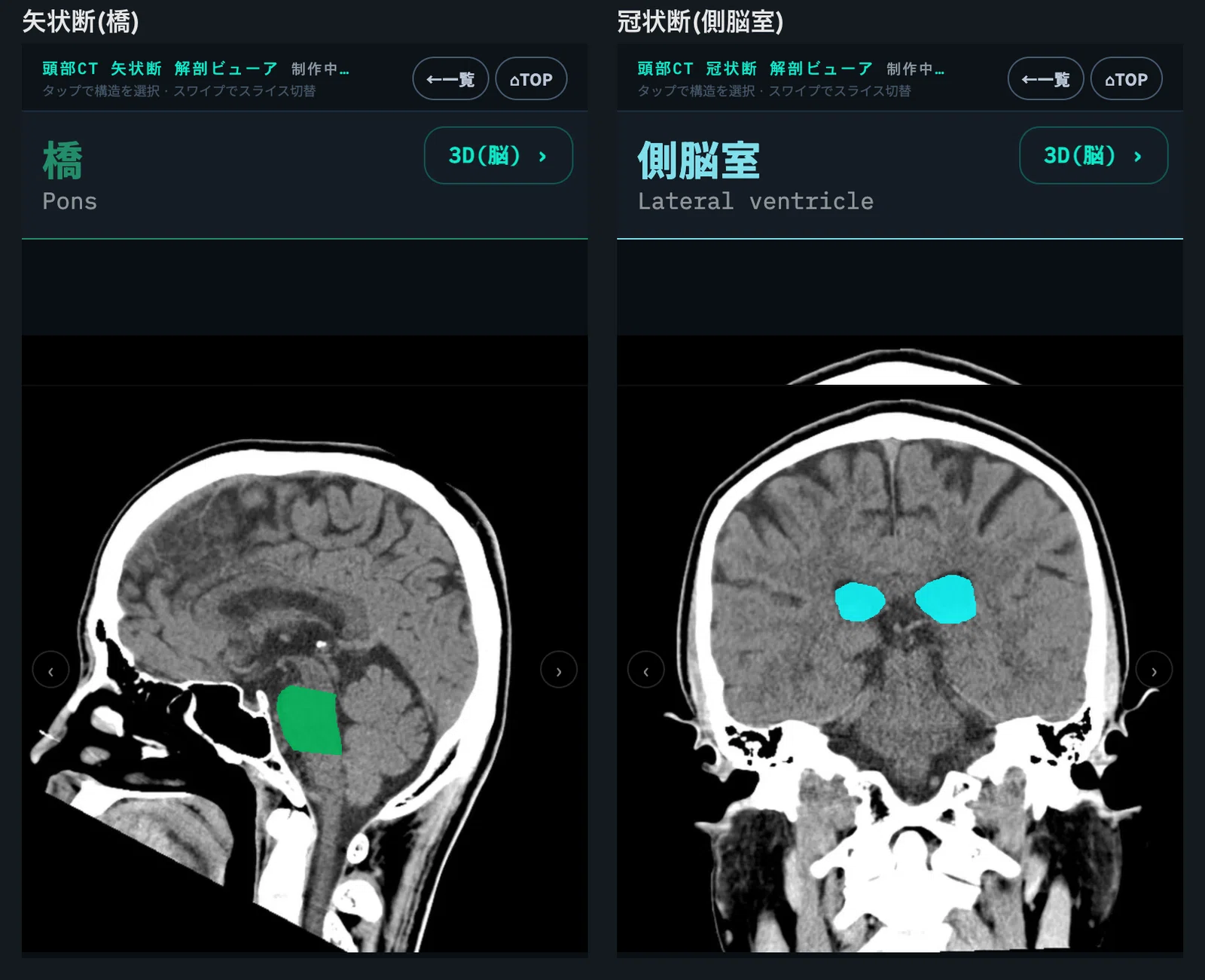 8月末から実は、画像診断cafeの頭部CTに着手しています｜ごろ〜にゃ
