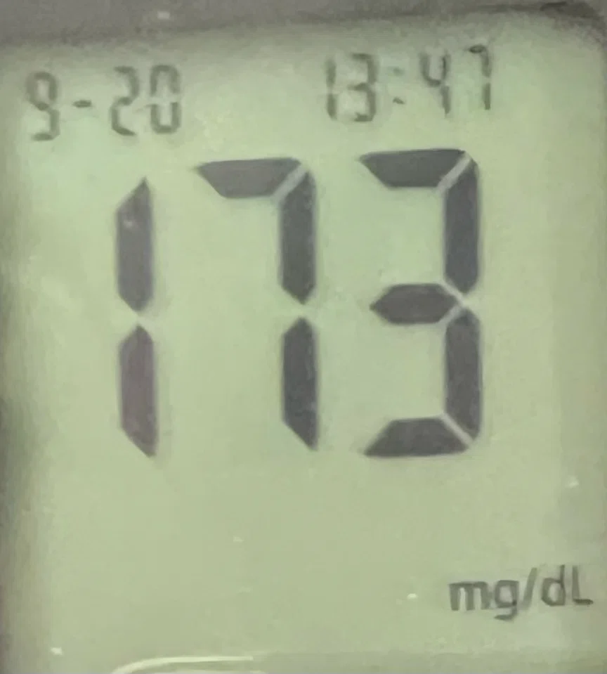 After Rice Experiment 3-Day Trip to Oita. Blood Glucose Experiment 14|mouchan