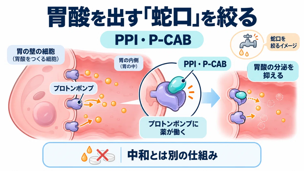 Why are these common stomach medicines chosen? Top 3 PPI and P-CAB ...