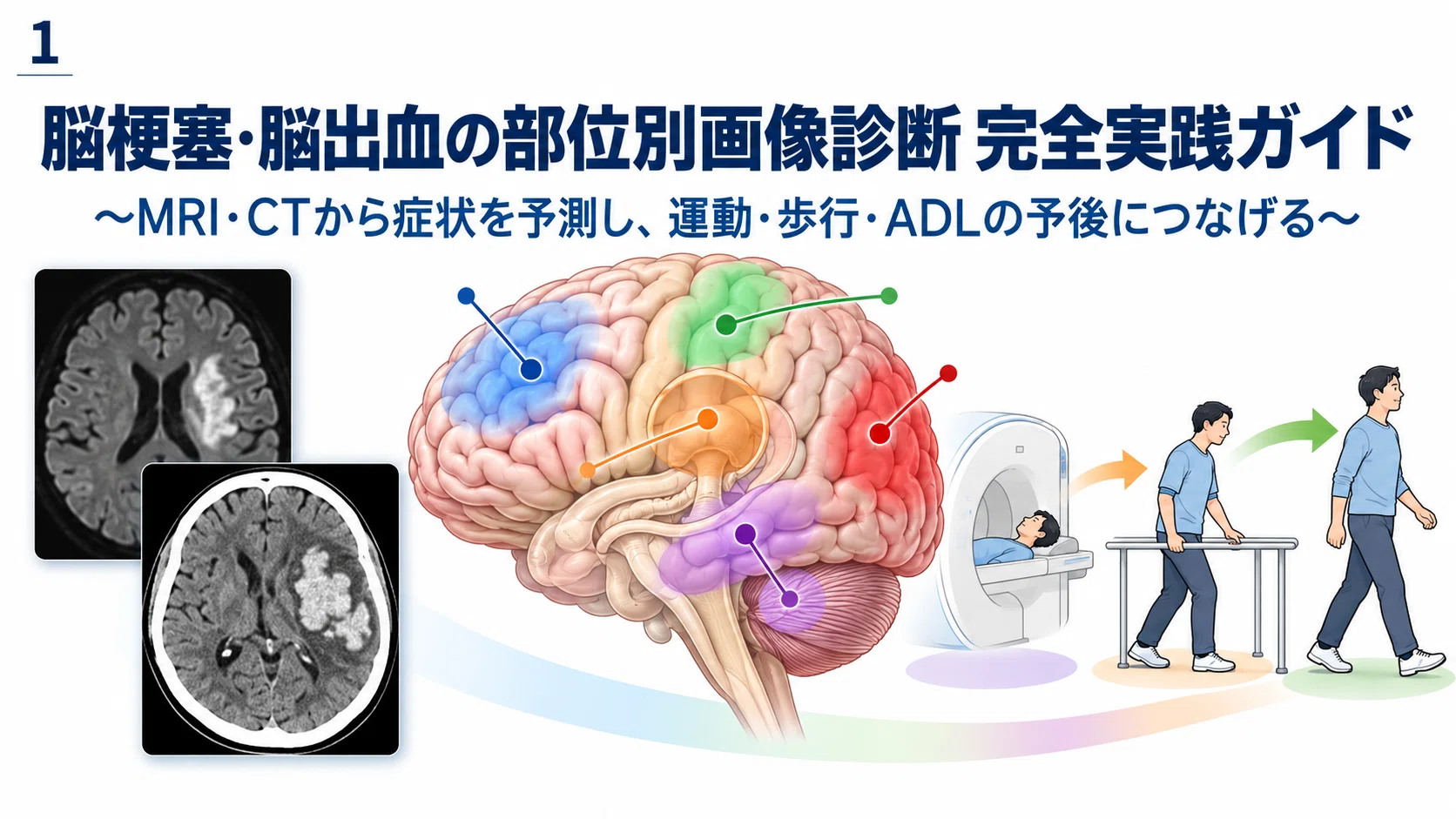 理学療法士のための脳梗塞・脳出血『画像評価』実践ガイド｜MRI・CT