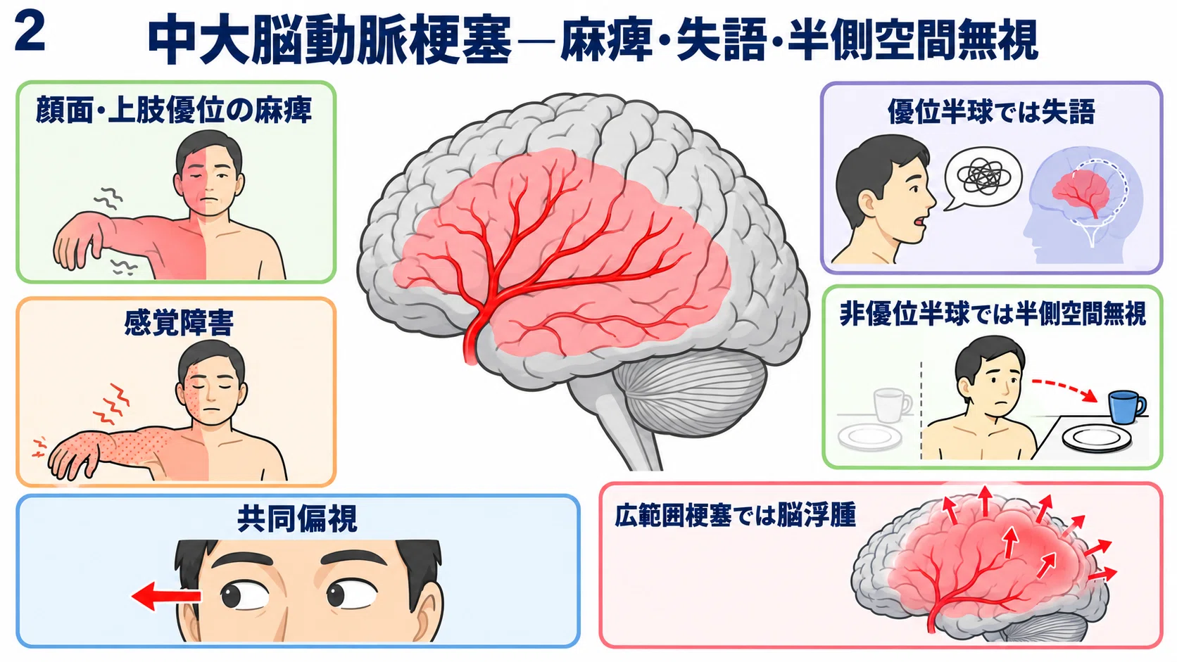 理学療法士のための脳梗塞・脳出血『画像評価』実践ガイド｜MRI・CT