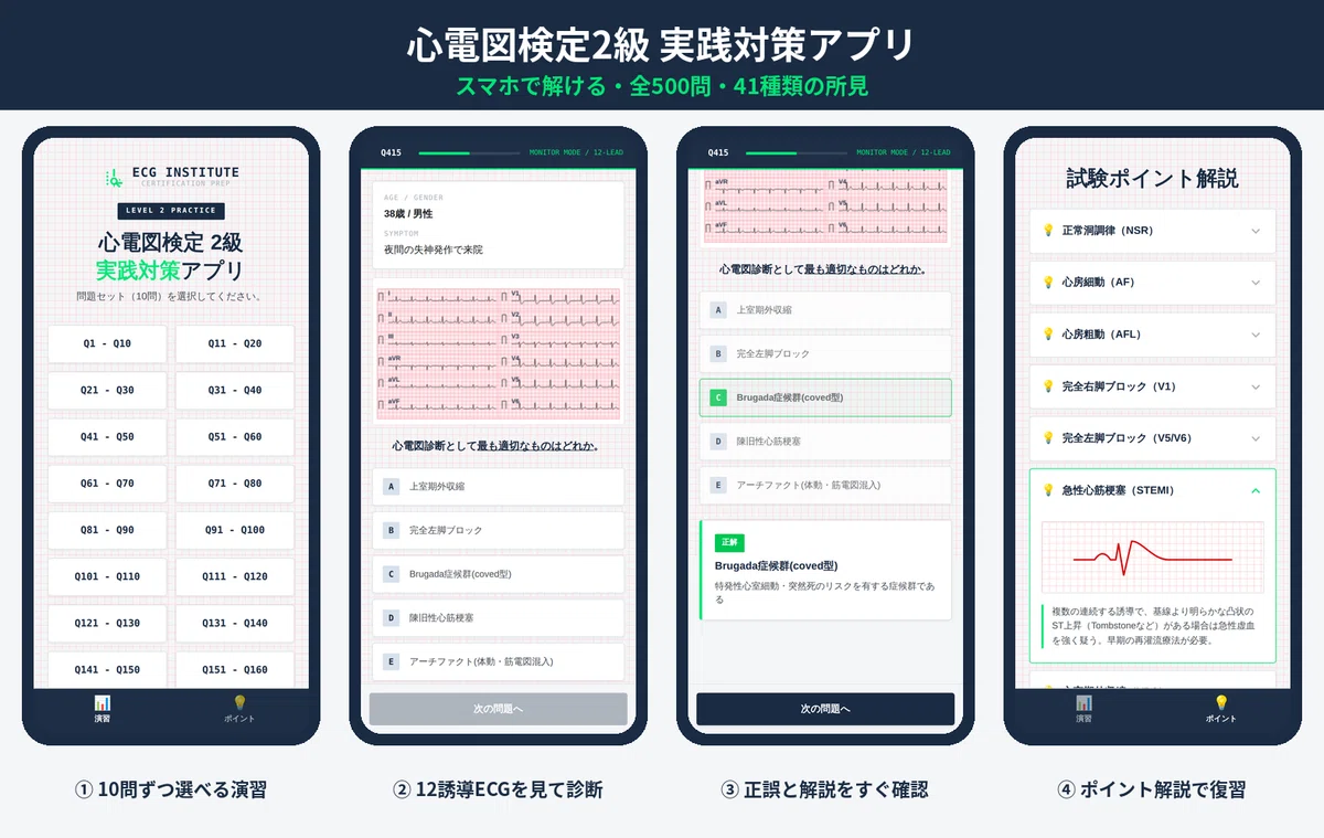 心電図検定2級】独学で合格する勉強法み＋スマホで解ける演習アプリ500