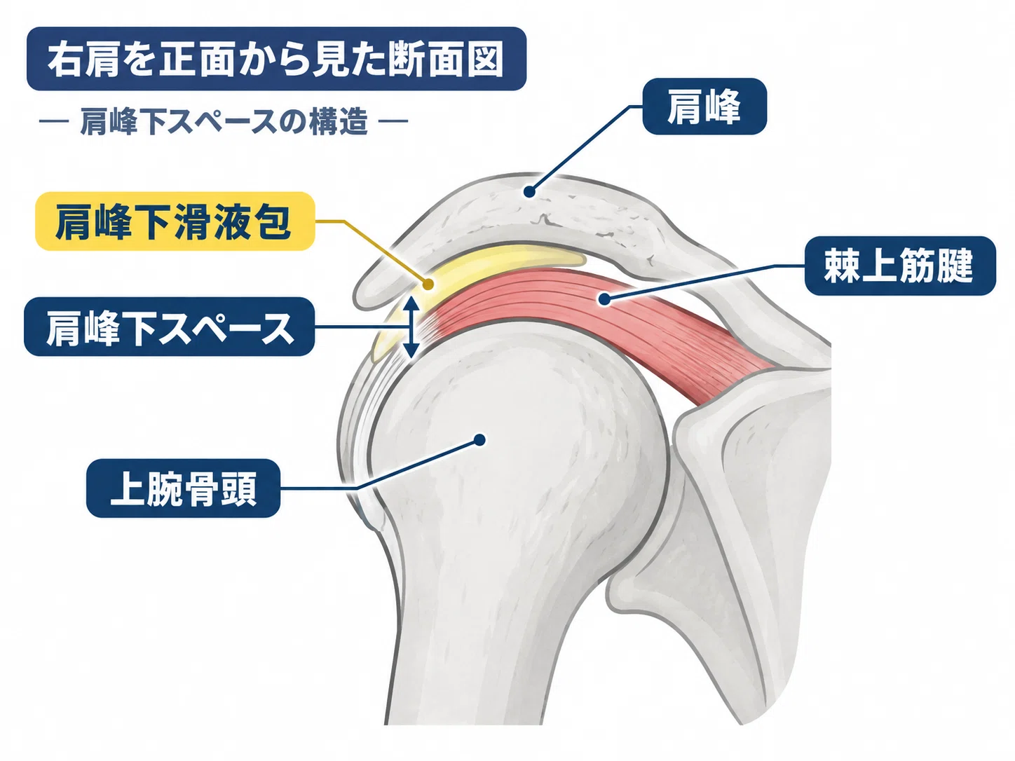 The Real Reason Your Shoulders Hurt During Side Raises | Understanding ...