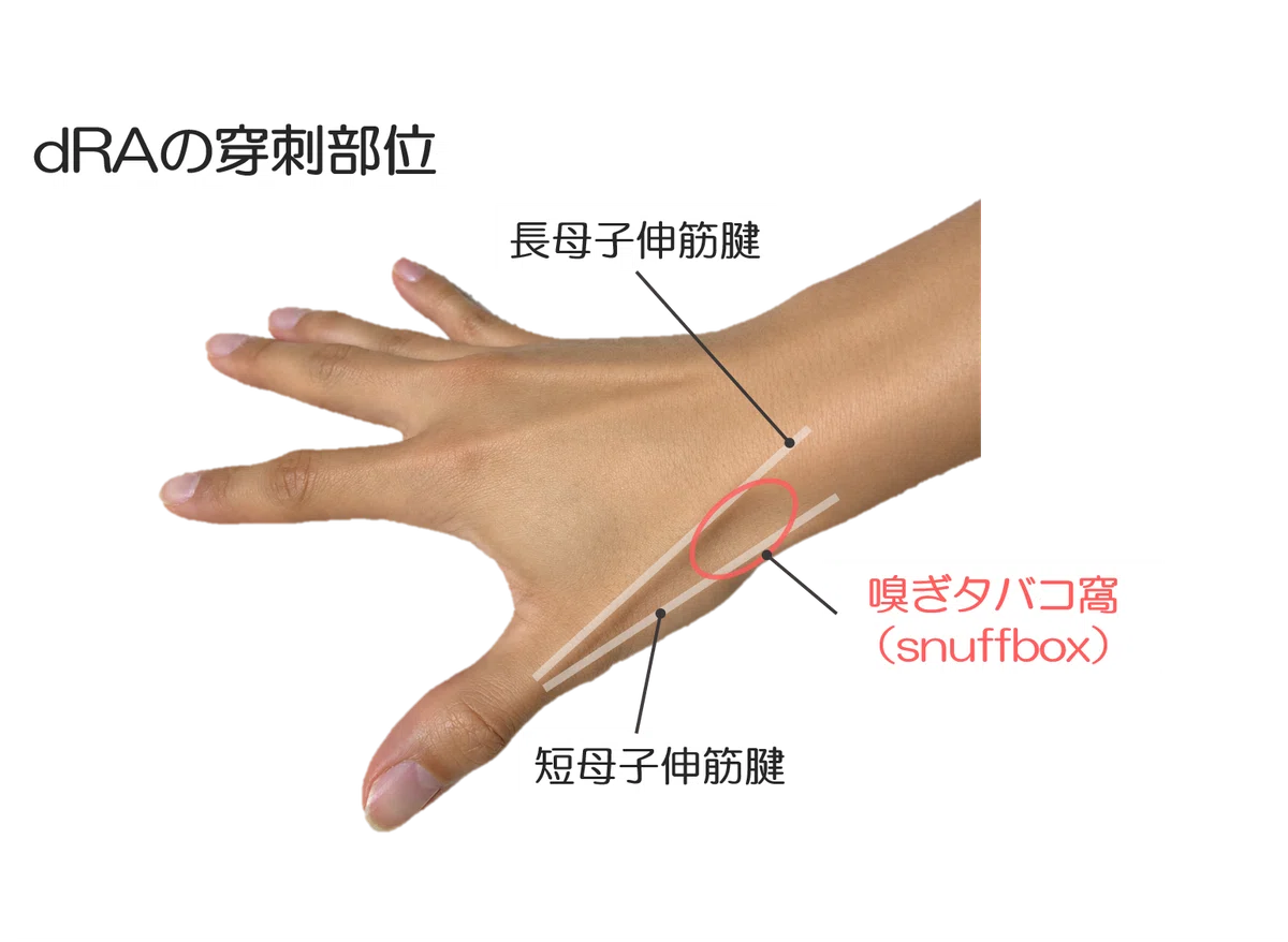 [Cardiac Cath Guide Vol. 7] Basics of 