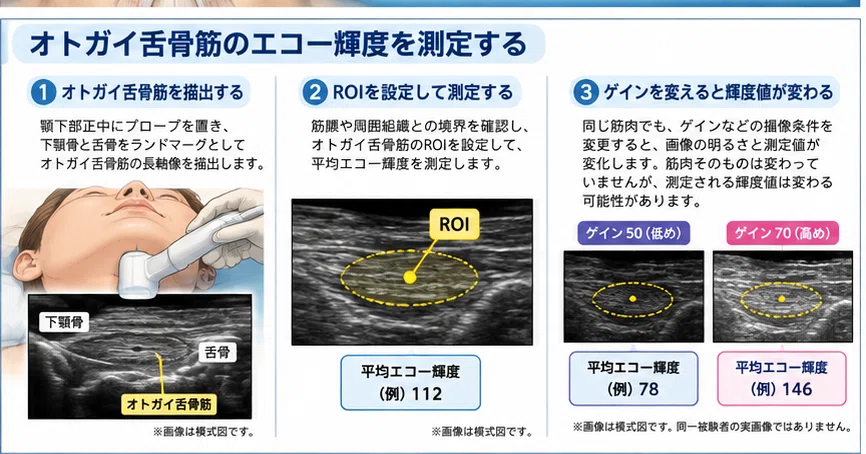 歯科嚥下エコー推進協会｜ 第14回嚥下関連筋の「質」はエコーで分かる？——エコー輝度と筋内脂肪を考える｜歯科嚥下エコー推進協会