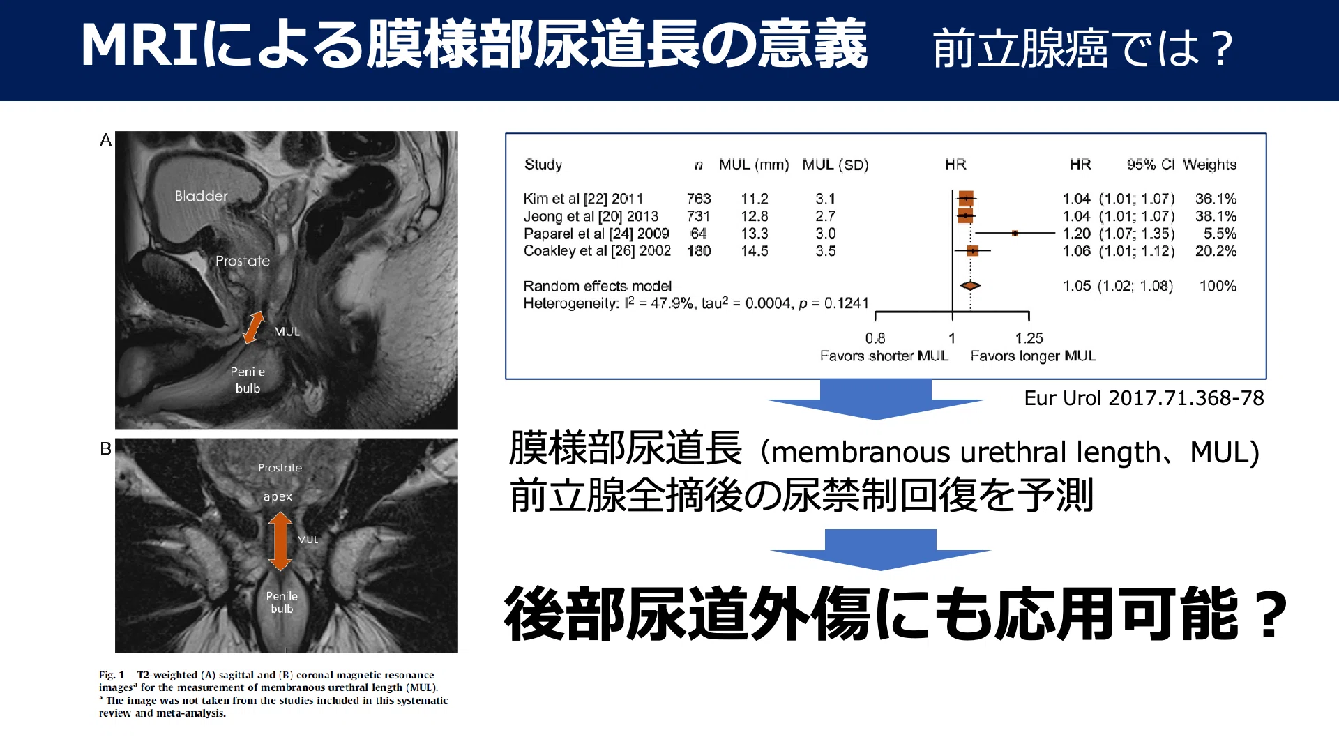 [Textbook of Urethral Stricture Part 151] Diagnosis of Urethral ...