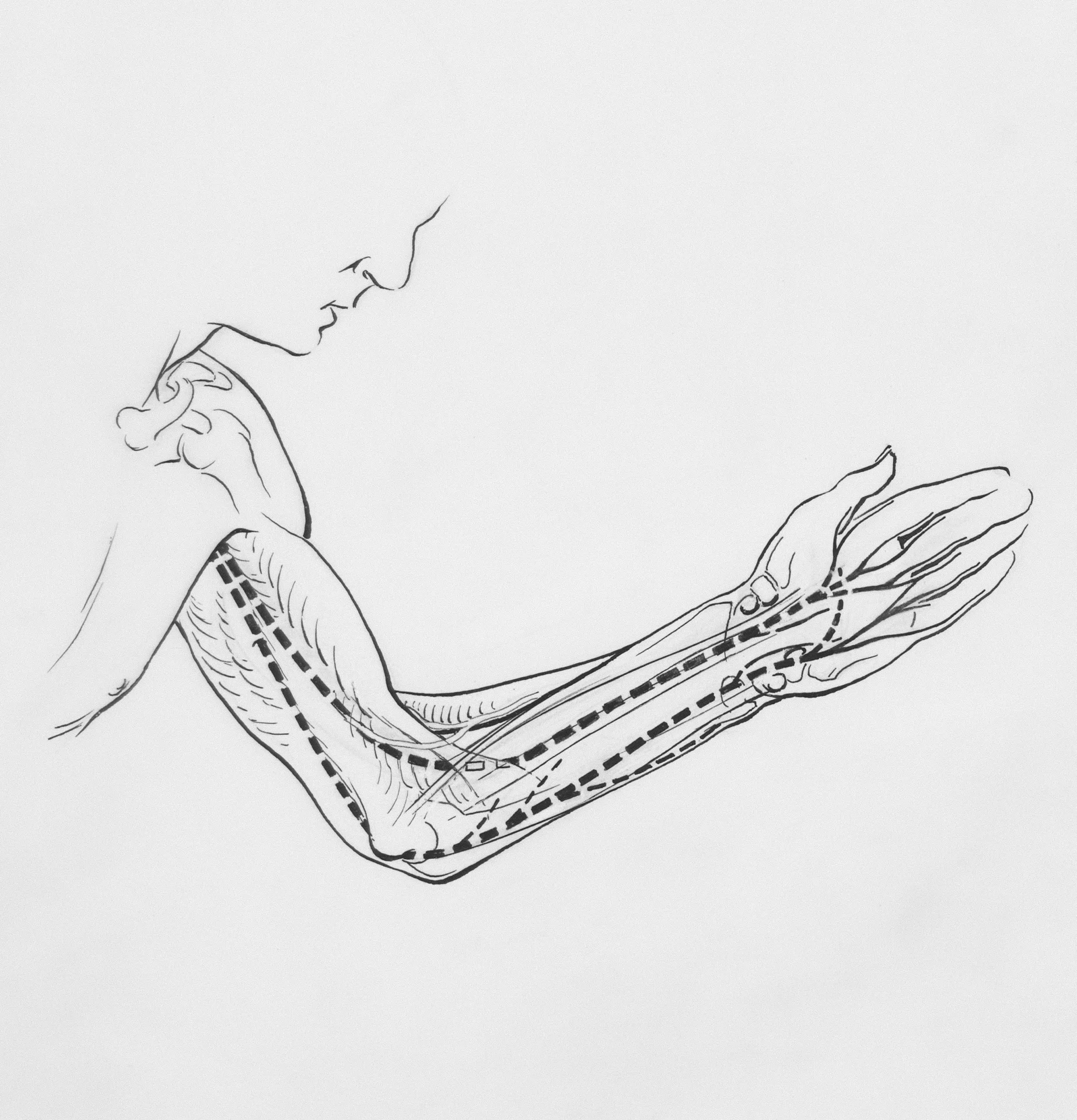 Preventing Elbow Injuries in Youth Baseball Pitchers｜ptbaseball