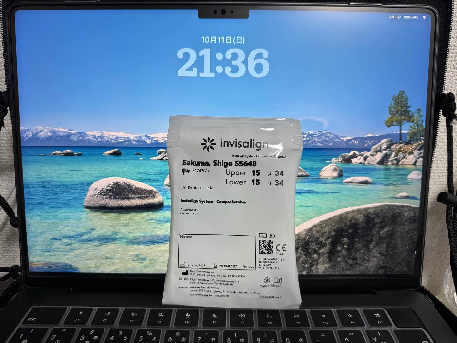 41-Year-Old Aligner Orthodontics Diary: Progress Report｜みち｜「在り方」を整える。