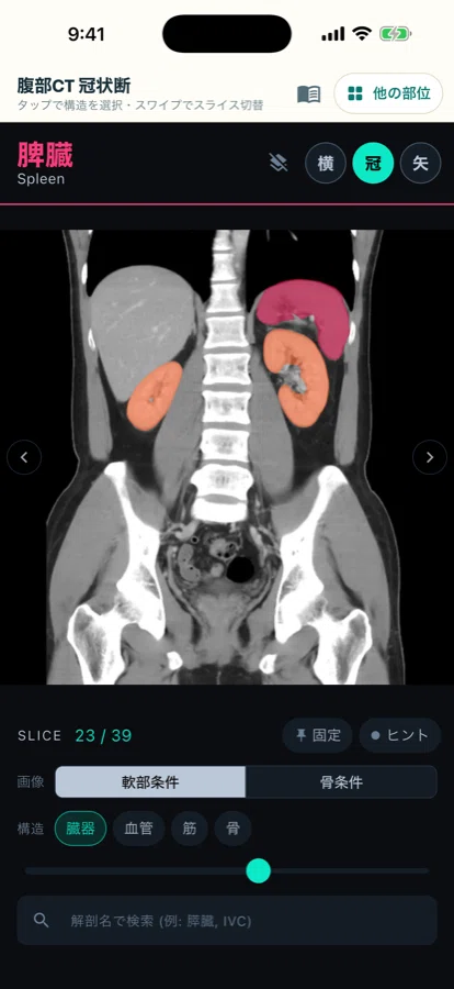 What is misty mesentery? How to think about and differentiate when the ...