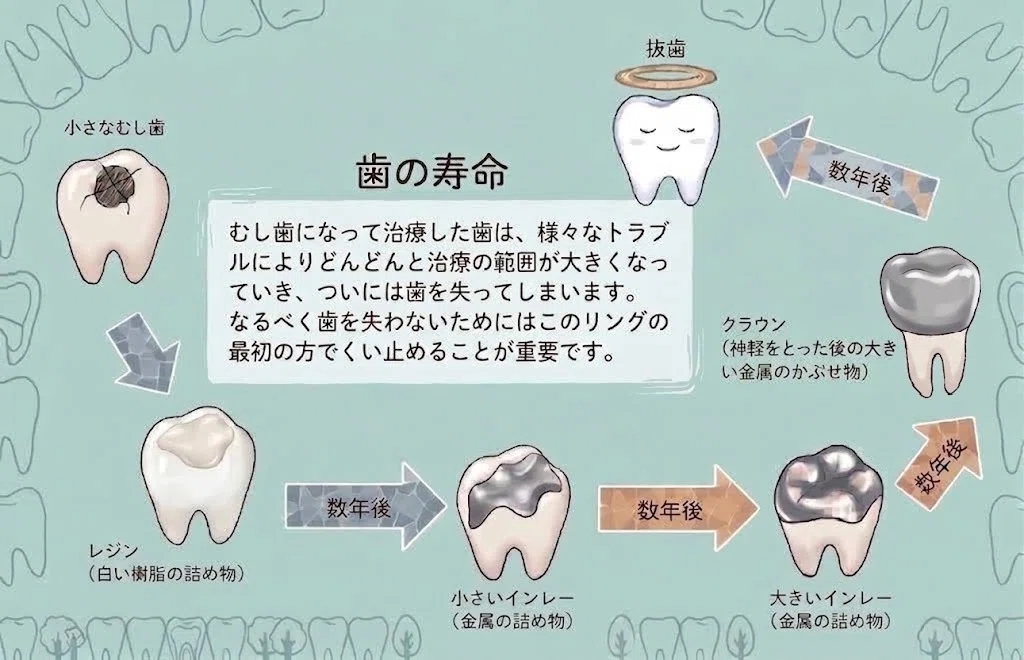Magnifier Vision Early-stage cavities are difficult even for dentists to detect ...