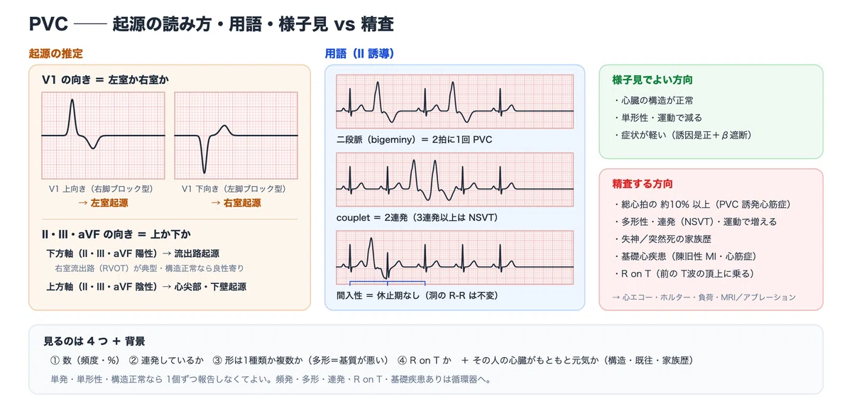 [ECG 2-2] Premature Contractions (PAC/PVC) — Hunting for the Culprit of ...