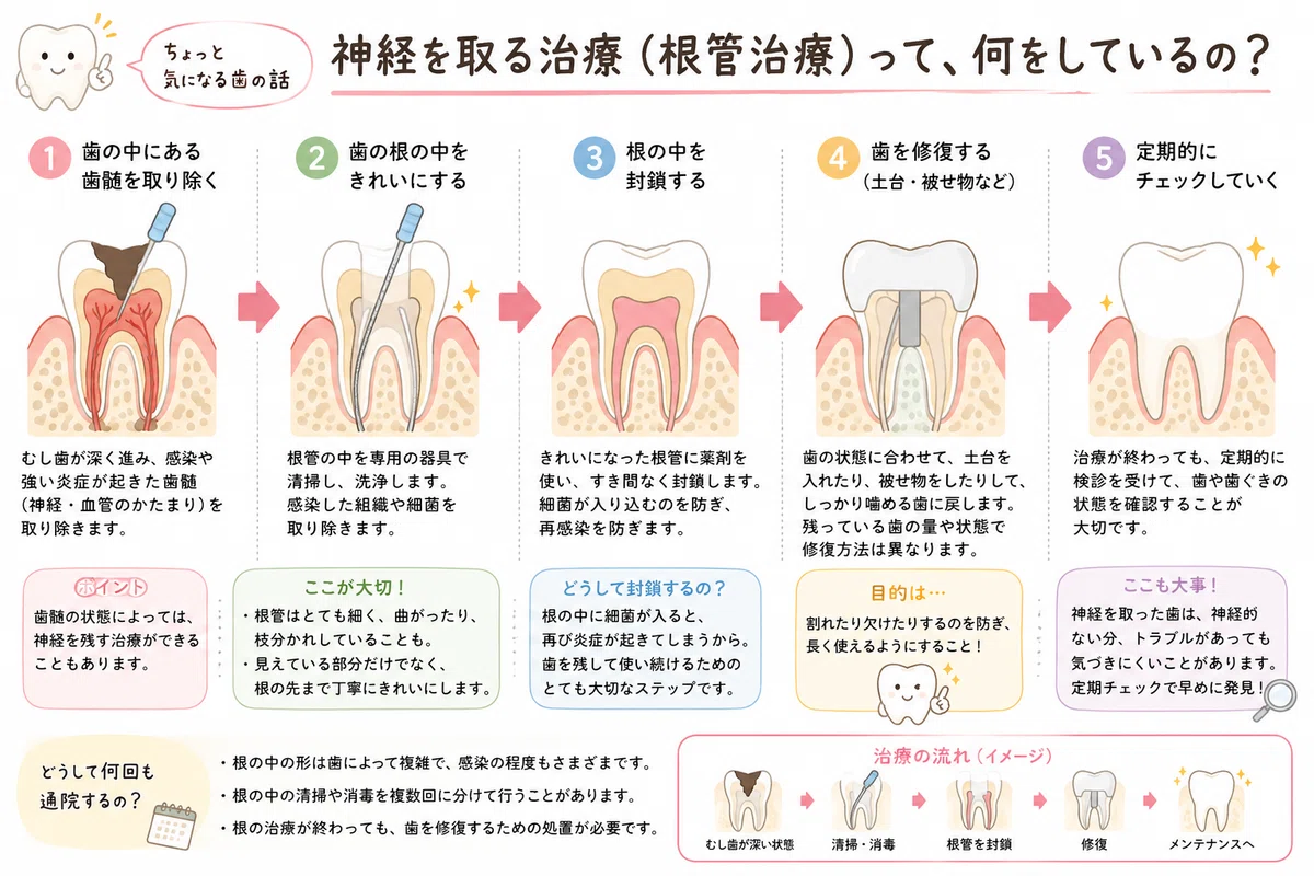 What happens during root canal treatment?｜歯の守護士 〜現役歯科衛生士は仮の姿