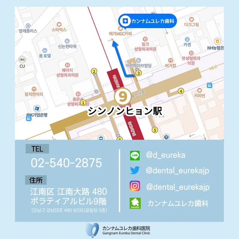 [Korean Dentist] Retainers after Orthodontic Treatment｜カンナムユレカ歯科