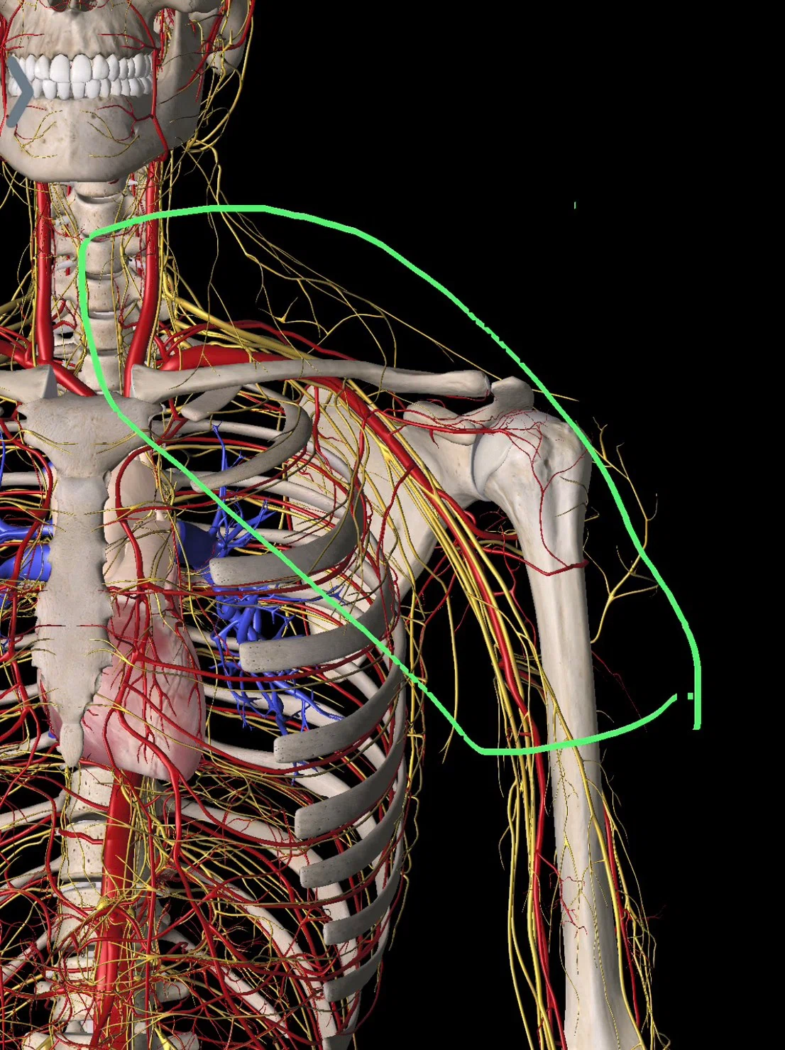 Can you treat thoracic outlet syndrome? Regarding numbness in the ...