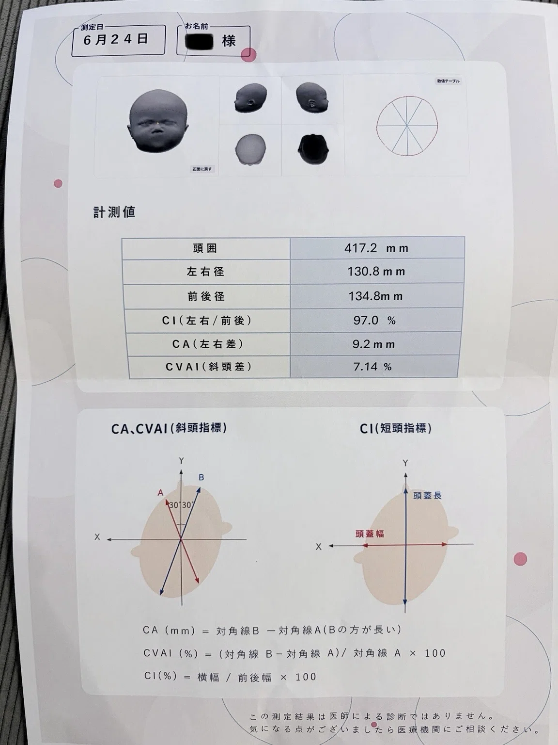 [Mild Flat Head Syndrome] Helmet Therapy: To Do or Not to Do?｜育児の選択ノート ...